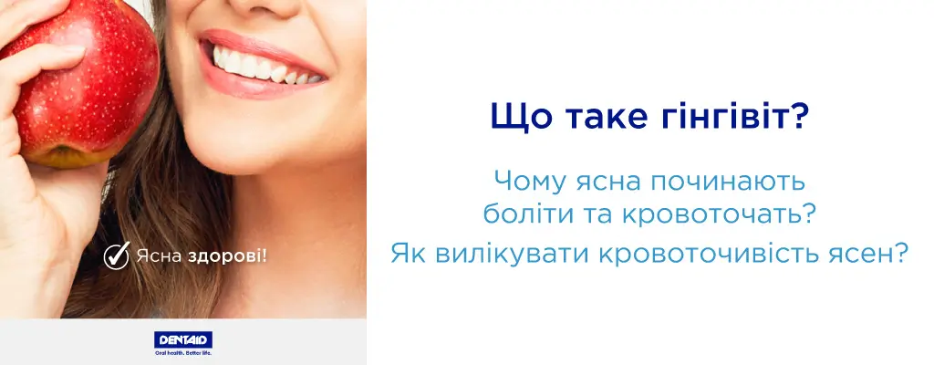 Що таке гінгівіт? Чому ясна починають боліти та кровоточать?