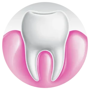 Icon Gingival