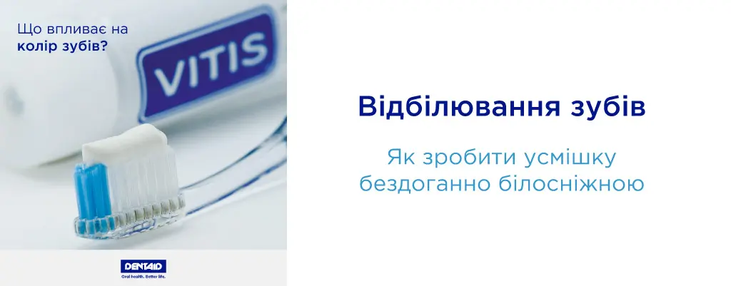 Відбілювання зубів: як зробити вашу усмішку бездоганно білосніжною