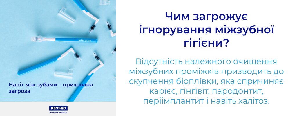 Чим загрожує ігнорування міжзубної гігієни? Відсутність належного очищення міжзубних проміжків призводить до скупчення біоплівки, яка спричиняє карієс, гінгівіт, пародонтит, періімплантит і навіть халітоз