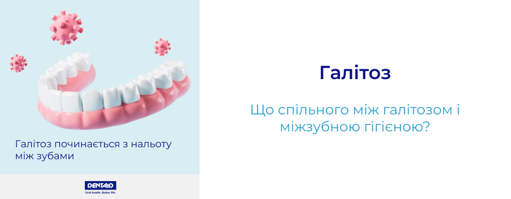 Галітоз Що спільного між халітозом і міжзубною гігієною?