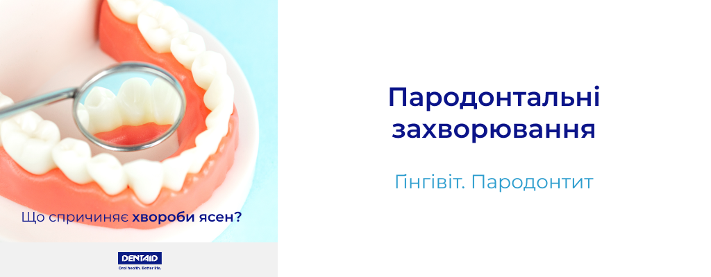 Пародонтальні захворювання Гінгівіт. Пародонтит